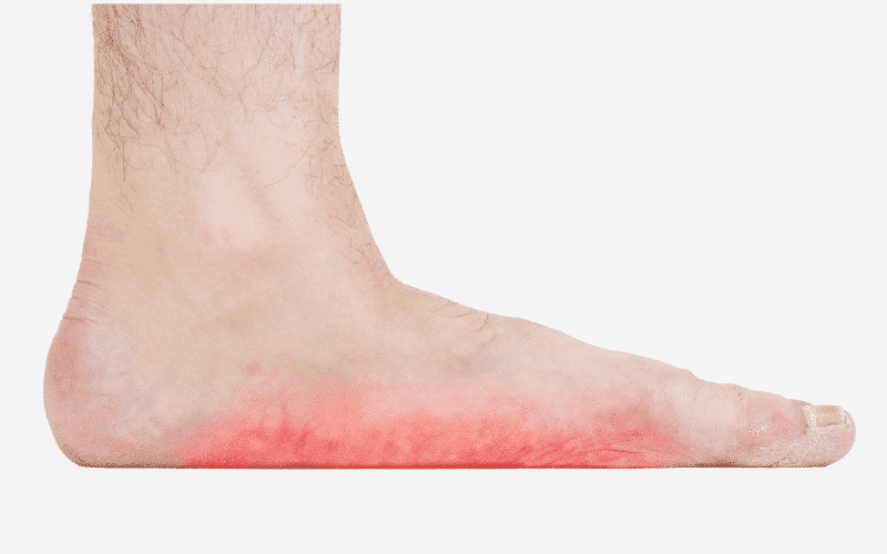 Best Custom Orthotic for Flat Feet Foot Pain