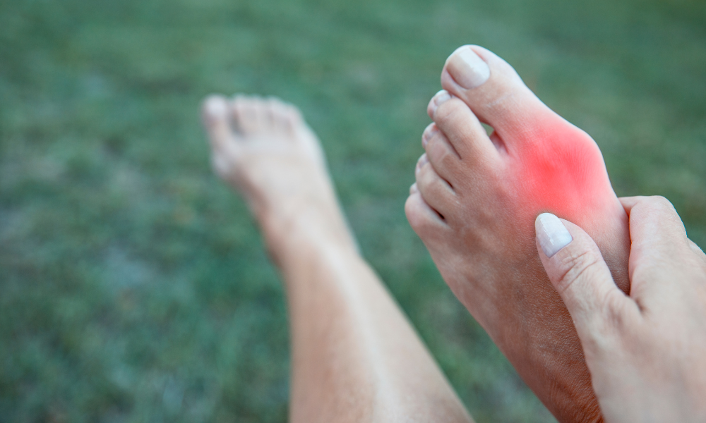 What is a Bunion corrector?