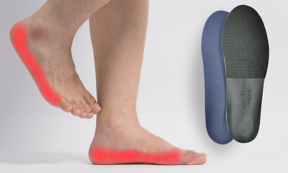 The best insoles for flat feet and overpronation, Bilt Labs custom orthotic insoles.