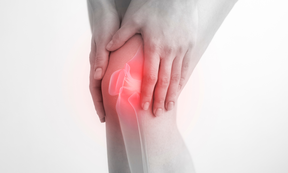 a image of a leg with red knee pain to show Can orthotics help knee pain?