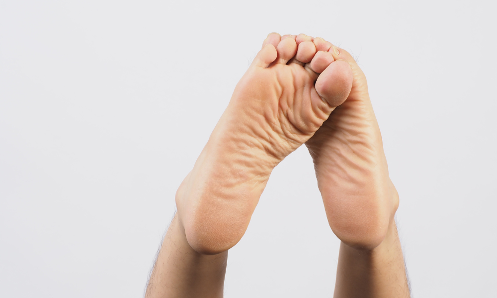 Feet with overpronation and flat feet.