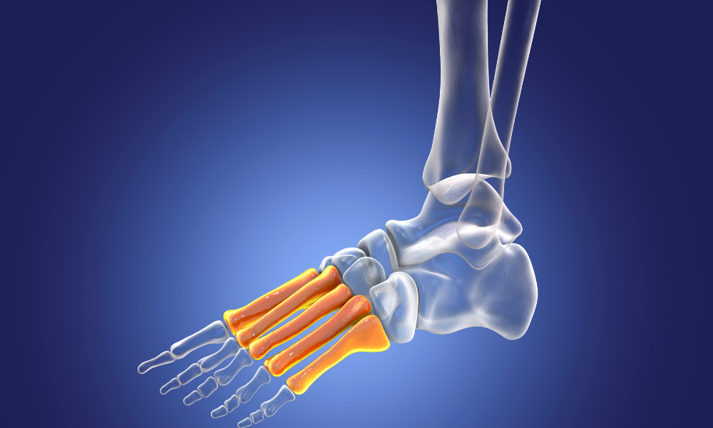 Tarsal Tunnel Syndrome: Causes, Symptoms, Treatments.