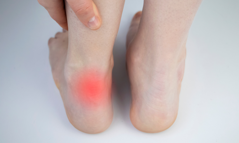 Foot Tendonitis