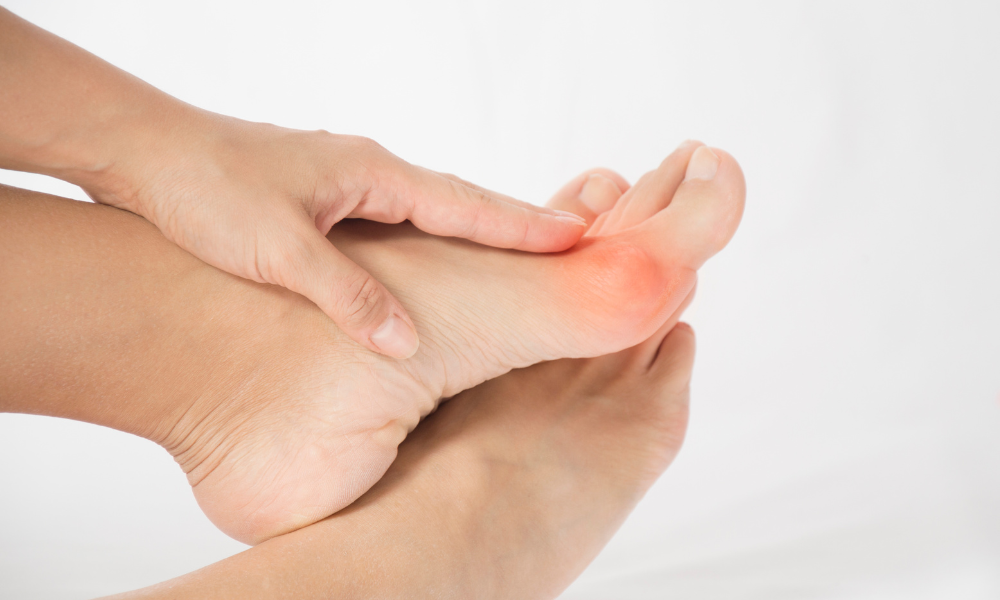 Will Surgery Help My Bunions?
