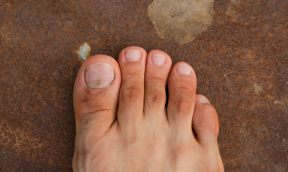 Why Are My Toes Burning?