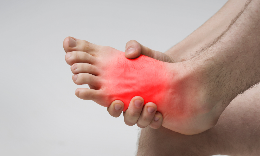 A picture indicating top of foot pain with red, irritated skin.